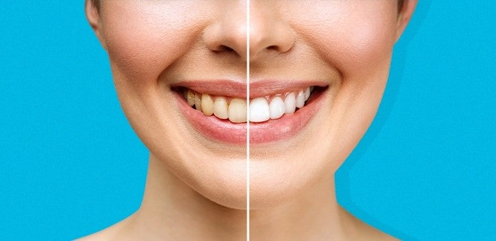 The evolution of oral care from chew stick to three-sided sonic